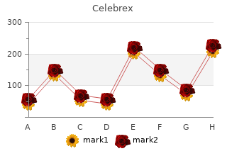 purchase celebrex 200 mg