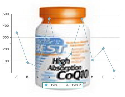 purchase feldene 20mg mastercard