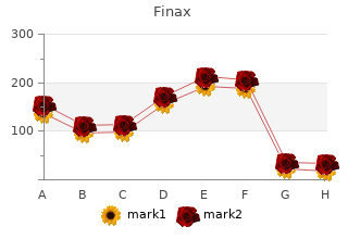 1mg finax amex