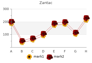 buy 150 mg zantac visa