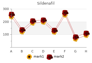 cheap 75 mg sildenafil with mastercard