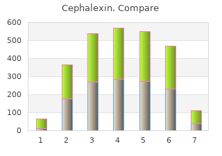 purchase 750 mg cephalexin with mastercard