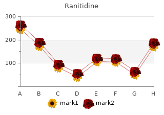 cheap ranitidine 150 mg without prescription