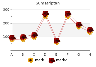 buy sumatriptan 50 mg mastercard