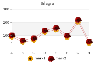 silagra 100 mg on-line
