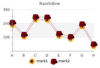 generic ranitidine 300 mg fast delivery